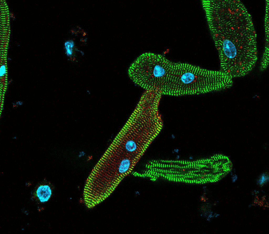 Cardiomyocyte imaging · Foo Lab, NUS