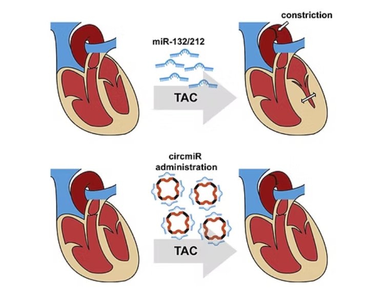 Functional Therapeutics — miR-132/212 TAC